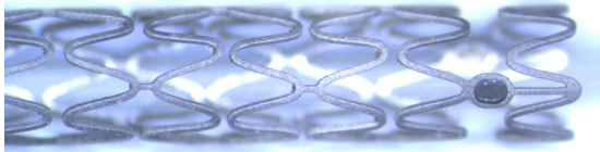 Casper MRS with markers